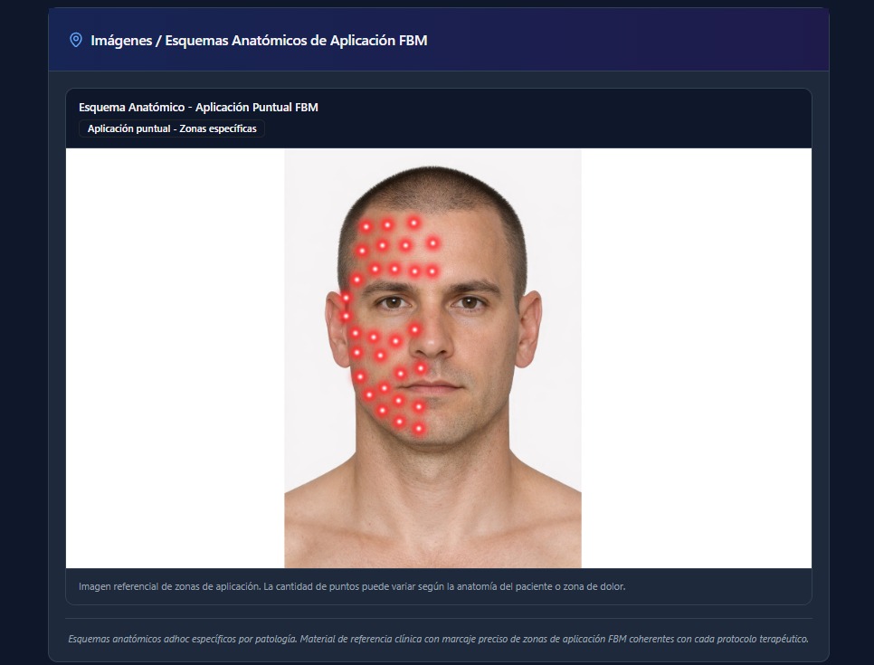 Esquema transcraneal con sistema 10/20 para fotobiomodulación
